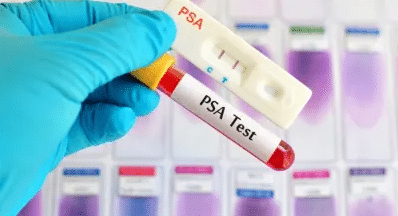 vial with blood for PSA testing getting life insurance with high PSA
